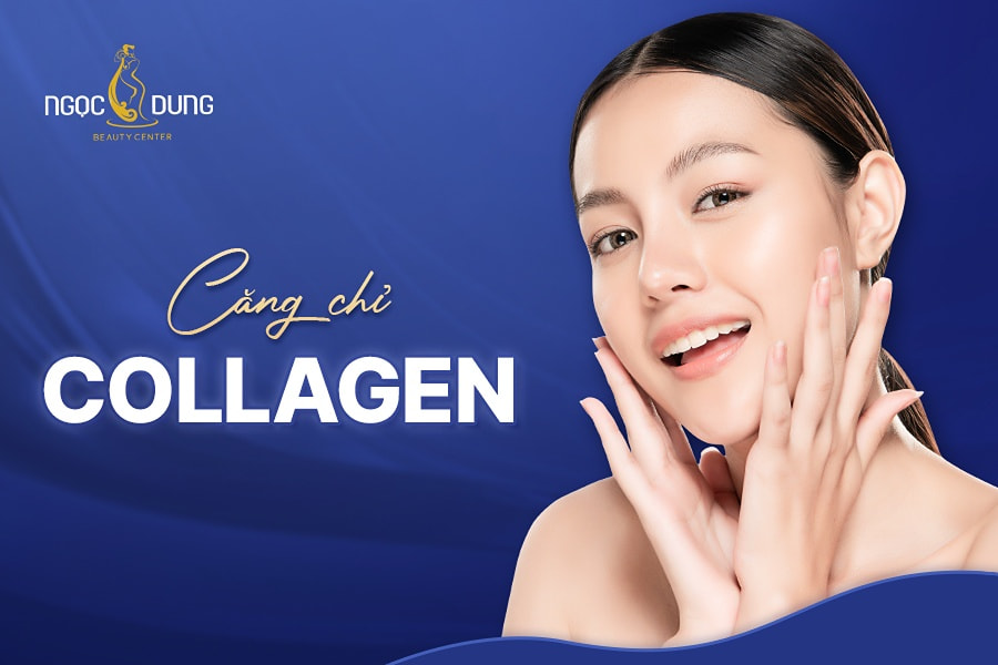 Căng chỉ collagen là gì?