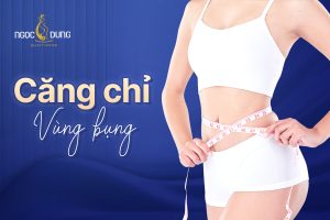 căng chỉ vùng bụng