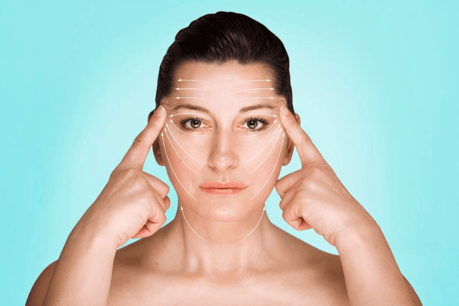 Căng chỉ vùng mắt giúp xóa mờ vết chân chim, giảm bọng mắt