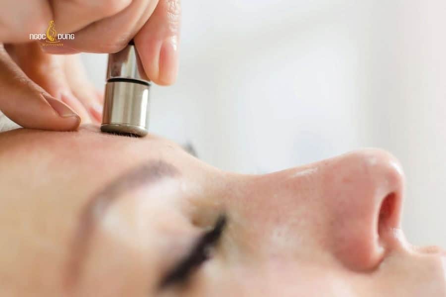 Hãy chuẩn bị nền da khỏe mạnh trước khi tiến hành Microdermabrasion