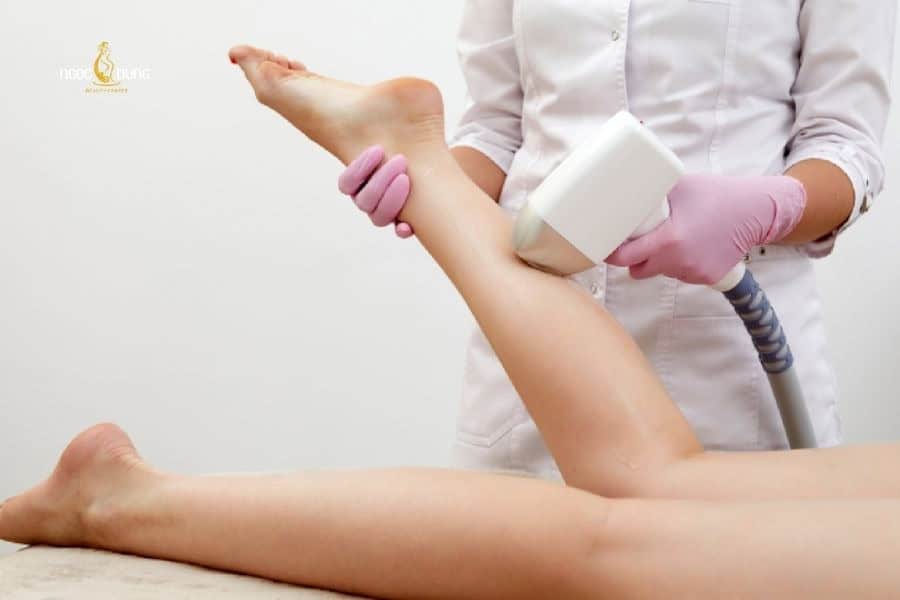 Chuyên viên tiến hành đi tia triệt lông lên vùng da cần điều trị