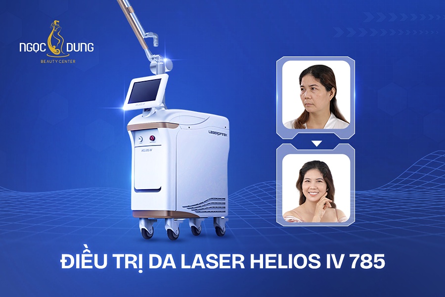 Điều trị da laser Helios IV 785