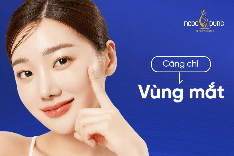 Giải pháp căng chỉ vùng mắt an toàn, hiệu quả