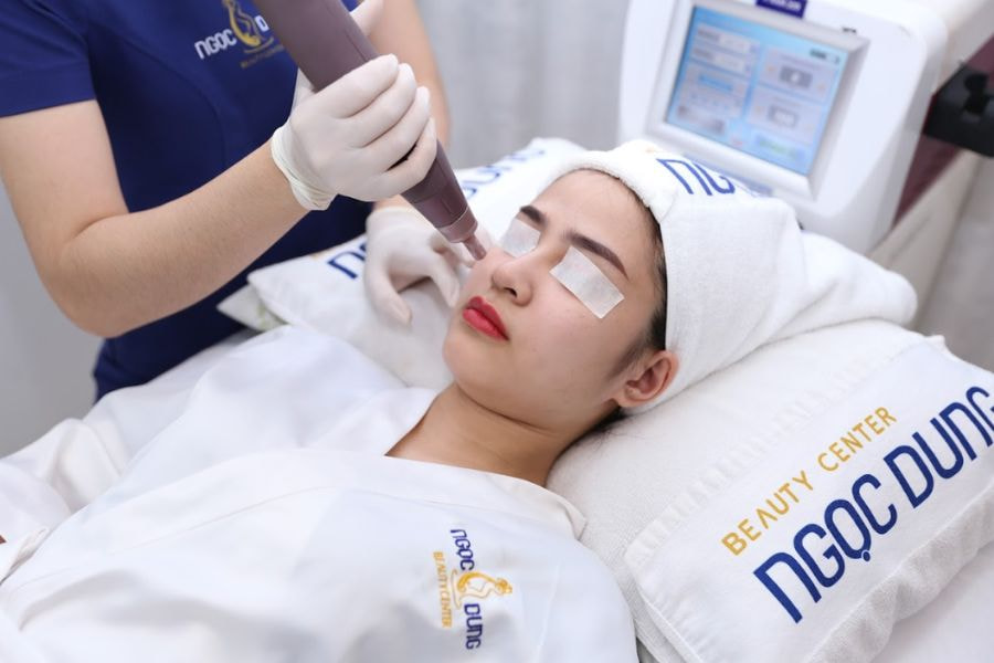 Laser trị nám tại TMV Ngọc Dung