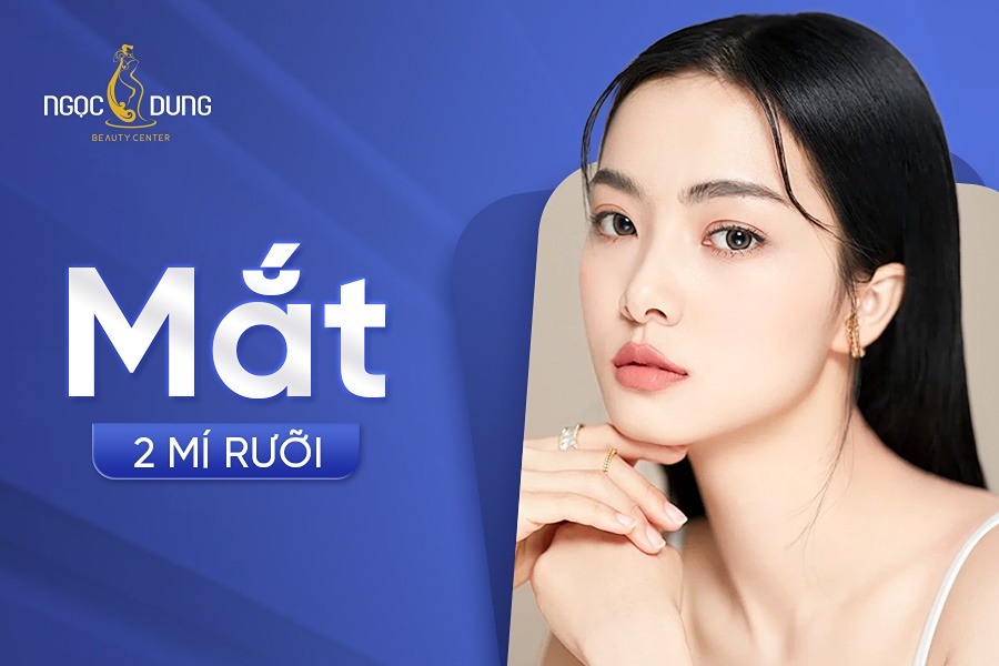 Mắt 2 mí rưỡi