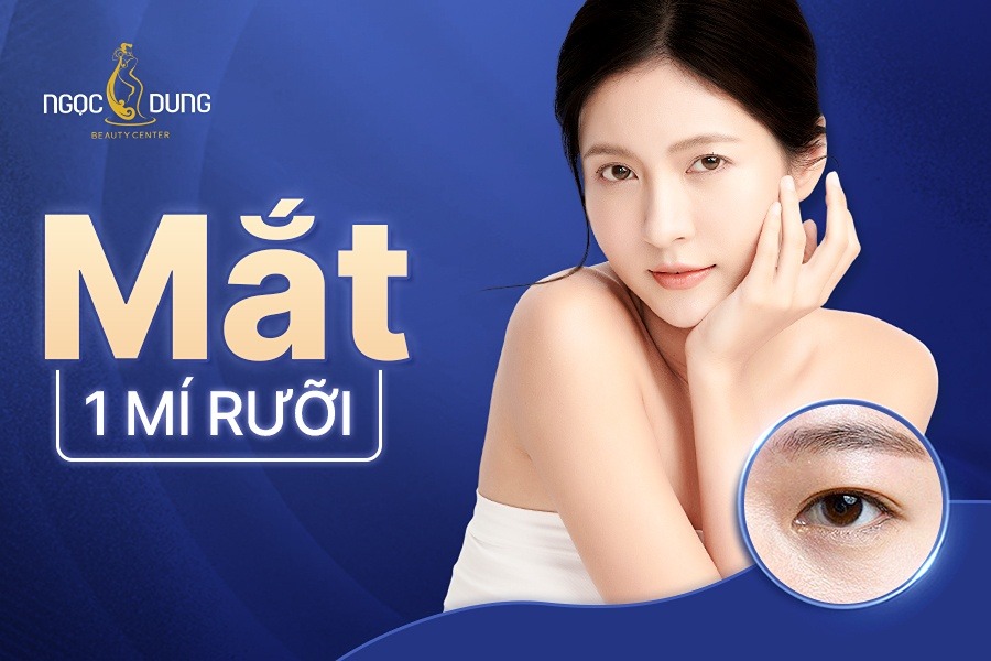 Mắt 1 mí rưỡi