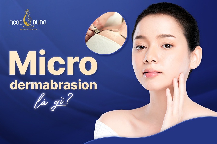 Microdermabrasion là gì?