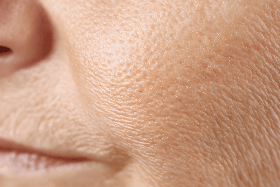 Những đối tượng nên sử dụng phương pháp nâng cơ Ultherapy