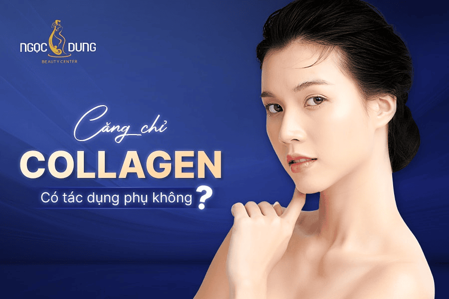 Tác dụng phụ của căng chỉ Collagen: Biến chứng và phòng ngừa 2 Những tác dụng phụ của căng chỉ Collagen mà bạn cần biết
