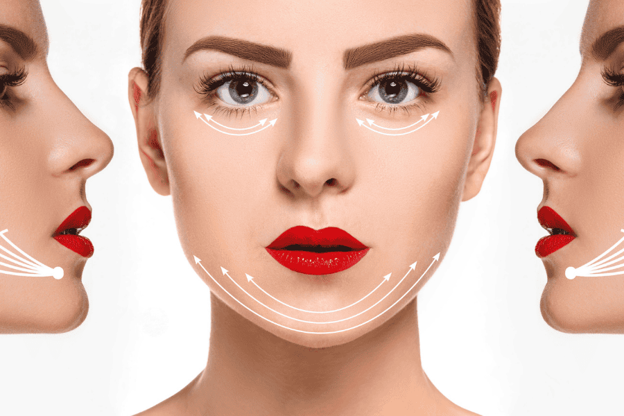 Căng chỉ Collagen là gì? Ưu điểm, bảng giá và quy trình 4 Những ưu điểm của phương pháp căng chỉ collagen trẻ hóa da