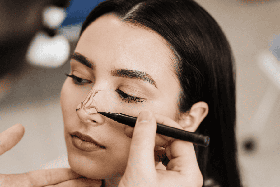 Những ưu điểm vượt trội của nâng mũi không phẫu thuật 