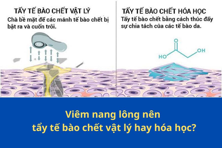 Hãy ưu tiên tẩy da chết hóa học đối với tình trạng da đang bị viêm nang lông