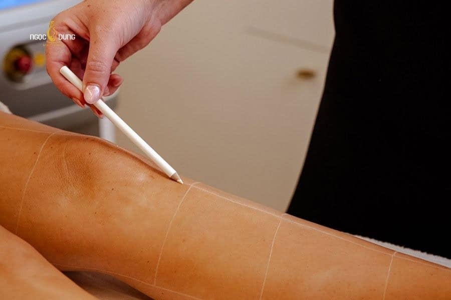 Bác sĩ thăm khám tình trạng lông để lên liệu trình phù hợp