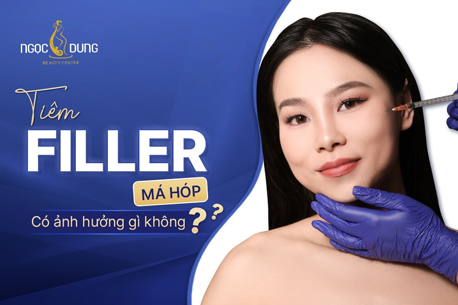 Tiêm filler má hóp có ảnh hưởng gì không?