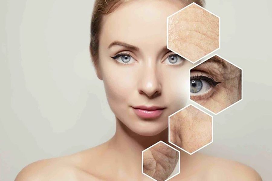 Công nghệ Ultherapy phù hợp với nhiều người, đặc biệt là người đang bị lão hóa da