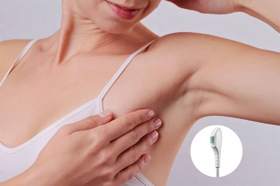 Thiết bị triệt lông ánh sáng hiện đại có thể sử dụng cho nhiều vùng da