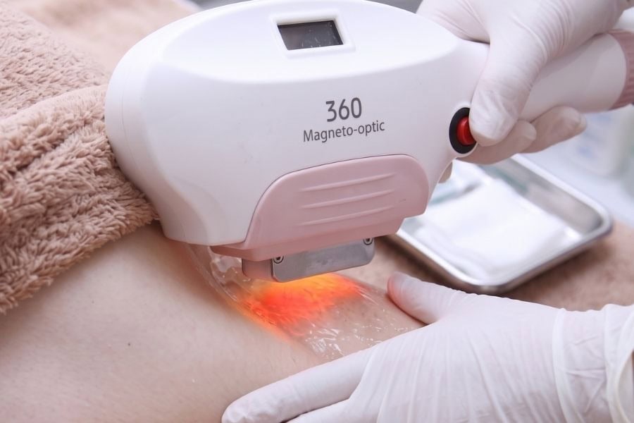 Ánh sáng máy triệt lông còn có thể mang lại kết quả triệt lông vĩnh viễn