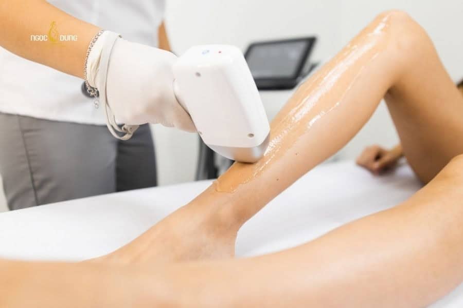 Công nghệ triệt hiện đại sẽ giúp giảm mật lông chứ không làm lông biến mất hoàn toàn