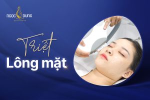 triệt lông mặt
