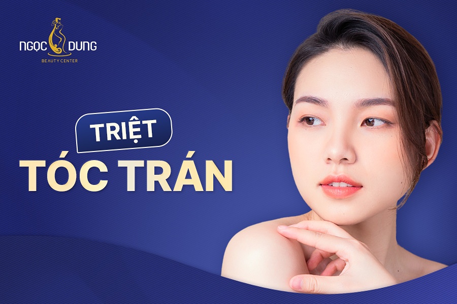 triệt tóc trán