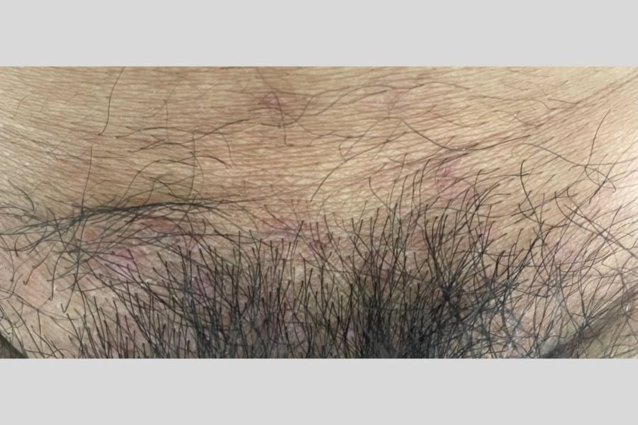 Lông vùng kín có nhiều lợi ích với hệ sinh dục