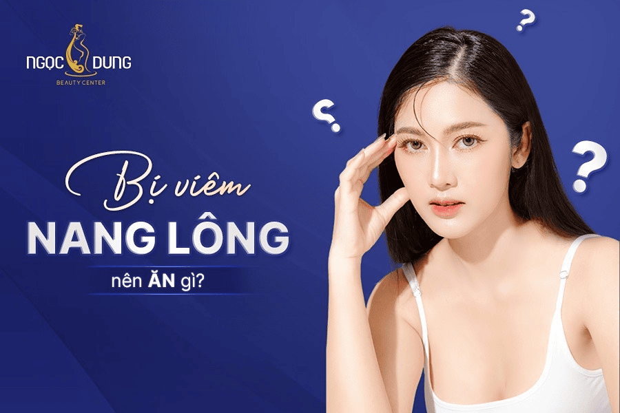 Viêm nang lông nên ăn gì, kiêng gì để nhanh khỏi?