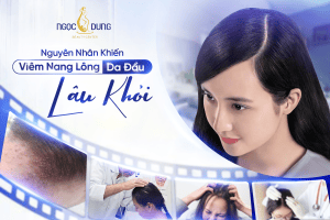 20260304 Pos SEO 833 1