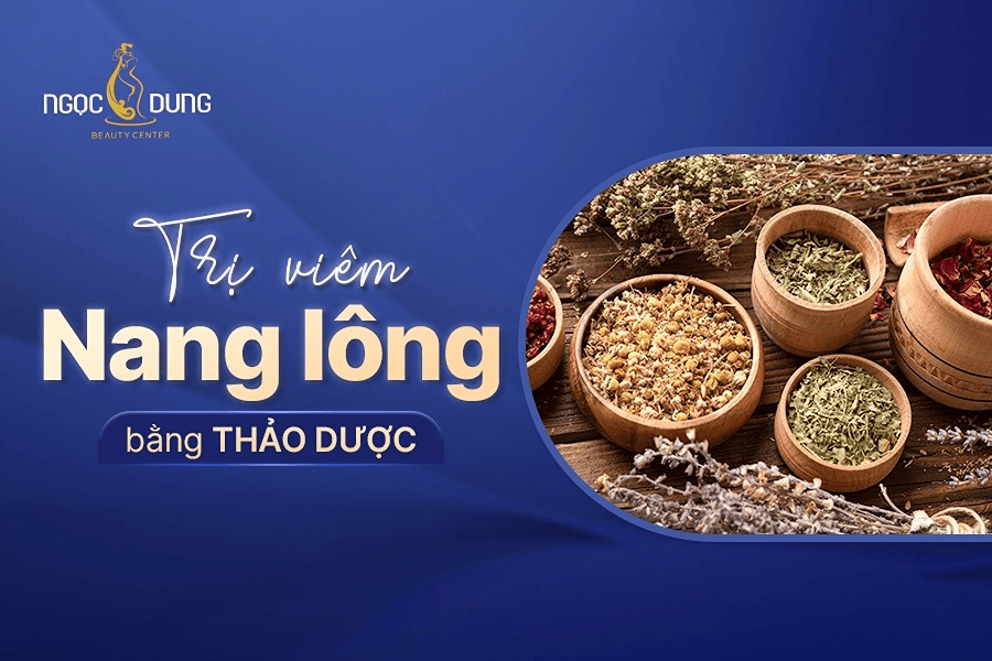 Cách trị viêm nang lông bằng thảo dược hiệu quả và an toàn 