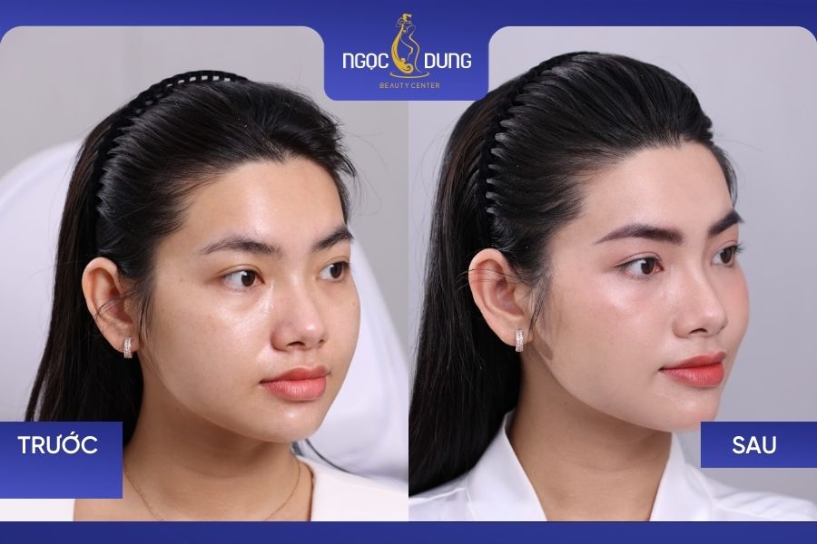 Kết quả phun mày chạm hạt tại TMV Ngọc Dung