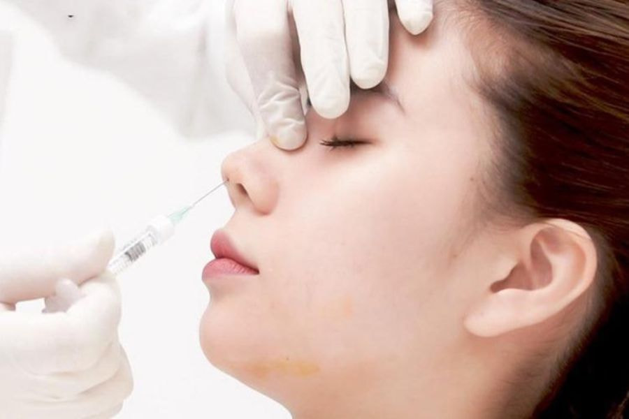 Tiêm filler theo quy trình chuẩn y khoa sẽ hạn chế tối đa nguy cơ nhiễm trùng