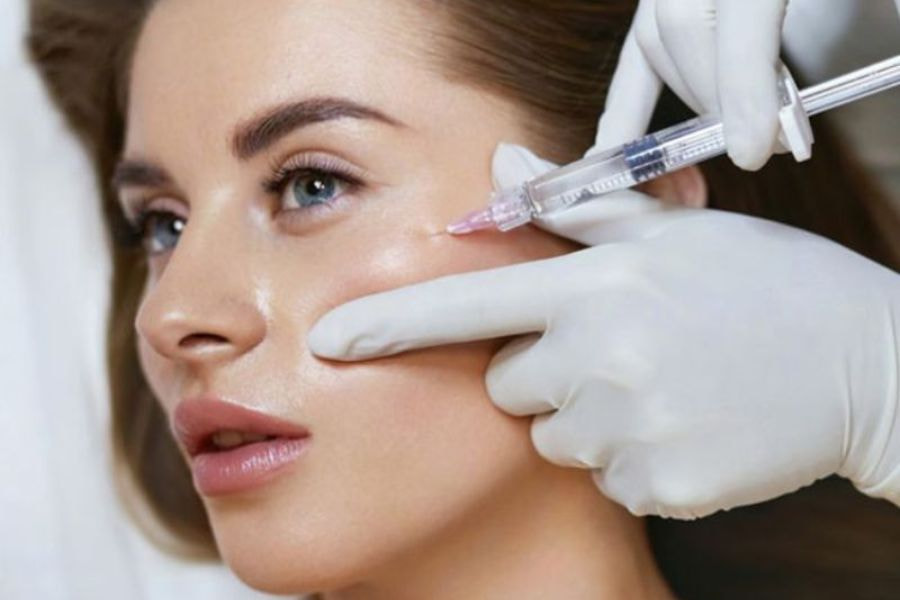 Tiêm tan filler thường là cách xử lý cho tình trạng filler di chuyển