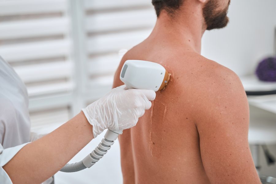 Triệt lông giúp nam giới thể hiện được đường nét cơ thể