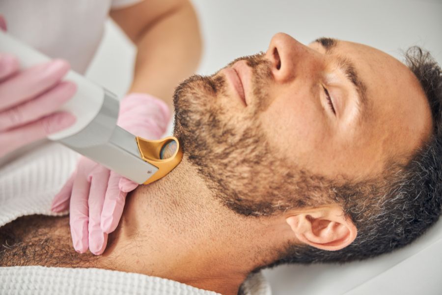 Triệt lông ngày càng được nhiều bạn nam quan tâm