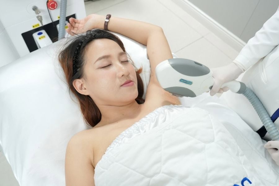 Quy trình triệt lông an toàn: 6 bước chuẩn y khoa mới nhất 6 Triệt lông nách tập trung vào hủy gốc nang lông và trị thâm