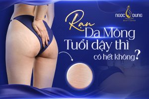 20260205 Pos SEO RanDaMong 1