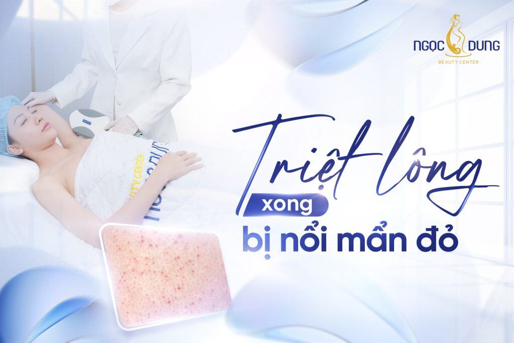 Triệt lông xong bị nổi mẩn đỏ phải làm sao