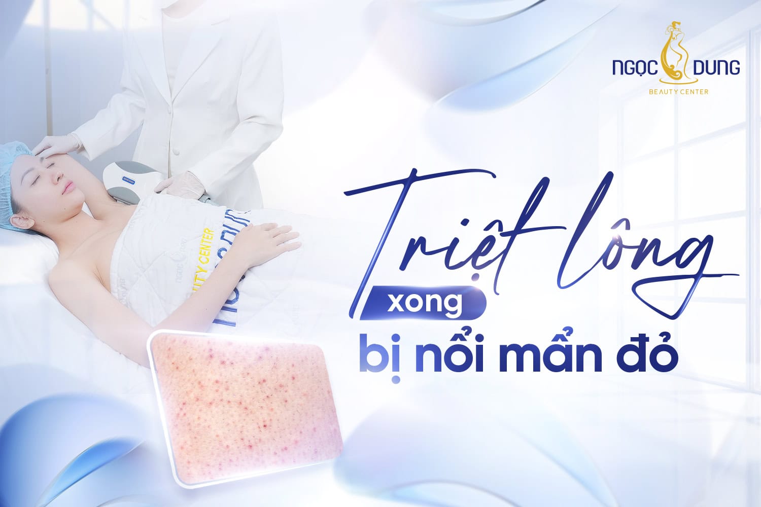 Triệt lông xong bị nổi mẩn đỏ phải làm sao