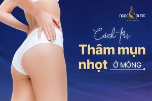 Cách trị thâm mụn nhọt ở mông
