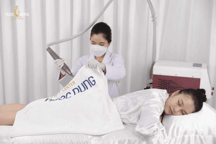 Điều trị rạn da bằng phương pháp Laser tại TMV Ngọc Dung