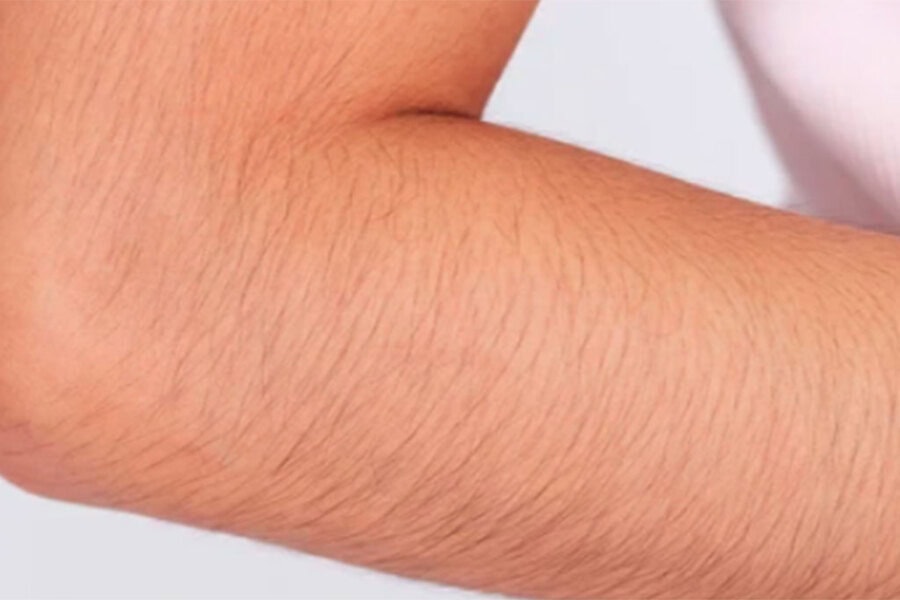 Lông mọc nhiều trong thai kỳ thường liên quan đến thay đổi hormone