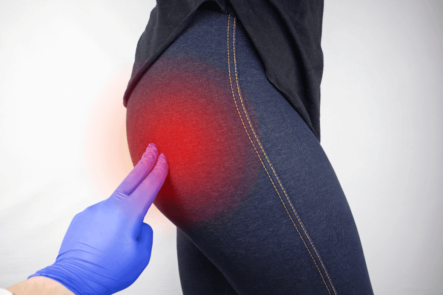 Mặc quần áo bó sát gây áp lực lên vùng mông khiến mông bị thâm 