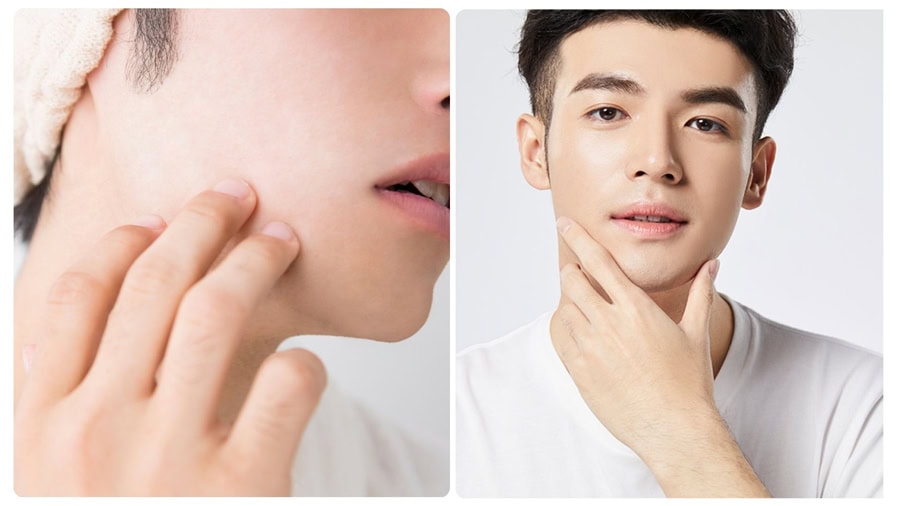 Cách triệt lông mặt nam an toàn và hiệu quả 3 Vì sao nhiều nam giới muốn loại bỏ lông mặt