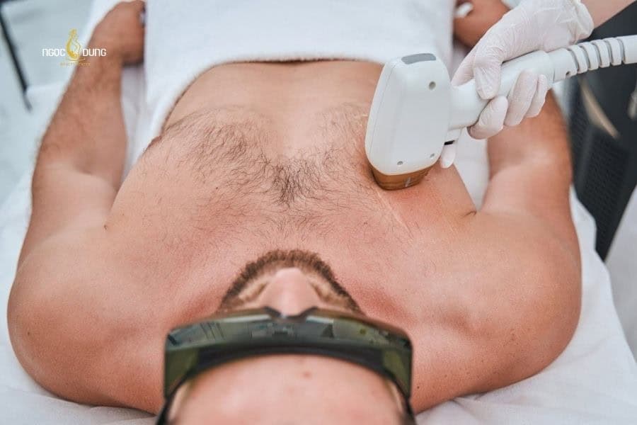 Ngọc Dung có quy trình triệt lông chuyên nghiệp và mang lại hiệu quả lâu dài