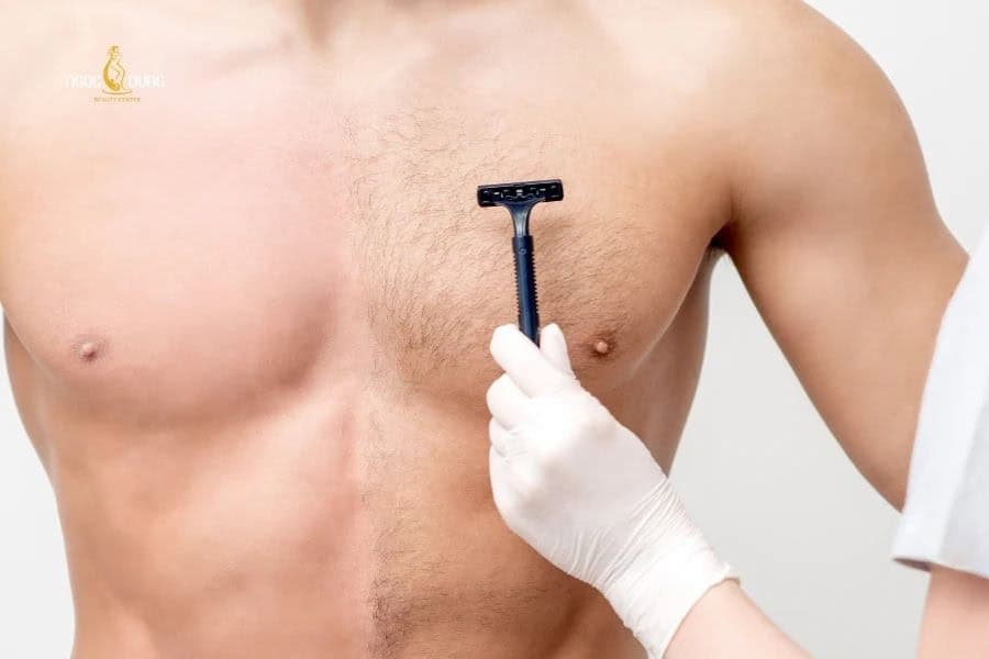 Triệt lông ngực hỗ trợ kiểm soát mùi cơ thể