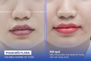 Chị Diệu Hương (31 tuổi) - Phun Môi Flora