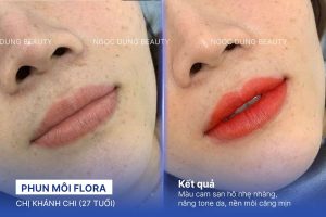 Chị Khánh Chi (27 tuổi) - Phun Môi Flora