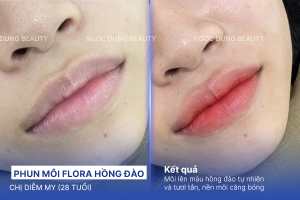 Phun môi flora hồng đào