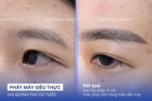 Chị Quỳnh Thư (31 tuổi) - Phẩy Mày Siêu Thực