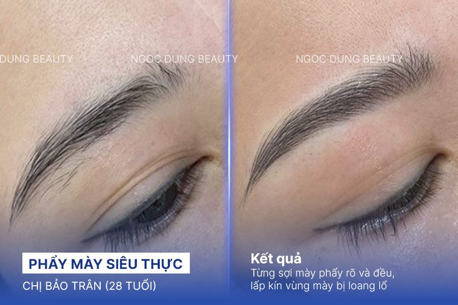 Chị Bảo Trân (28 tuổi) - Phẩy Mày Siêu Thực