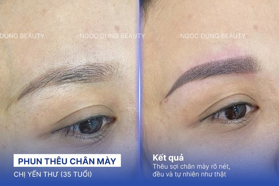 Chị Yến Thư (35 tuổi) - Phun Thêu Chân Mày
